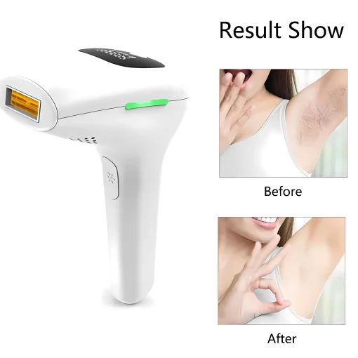 Depilador Laser IPL Profissional Feminino Remoção de Pelos Depilatório Elétrico Luz Pulsada Facial Corporal Bikini